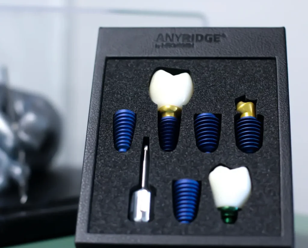 Impianti dentali in Albania: una guida completa per i pazienti che viaggiano all’estero